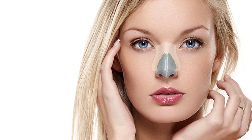 Rhinoplasty